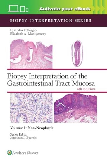Biopsy Interpretation of the Gastrointestinal Tract Mucosa Volume 1