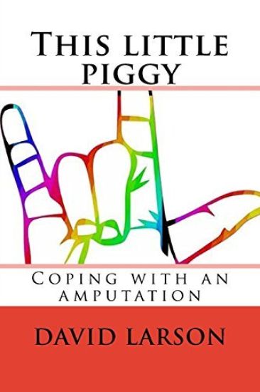 This little piggy: coping with an amputation