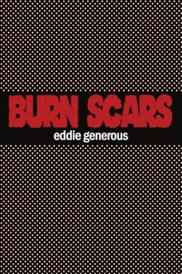 Burn Scars