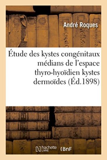 Contribution À l'Étude Des Kystes Congénitaux Médians de l'Espace Thyro-Hyoïdien Kystes Dermoïdes