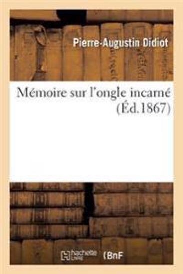 Mémoire Sur l'Ongle Incarné