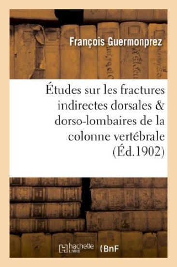 Études Sur Les Fractures Indirectes Dorsales & Dorso-Lombaires de la Colonne Vertébrale