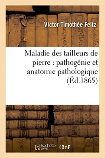 Maladie Des Tailleurs de Pierre: Pathogénie Et Anatomie Pathologique