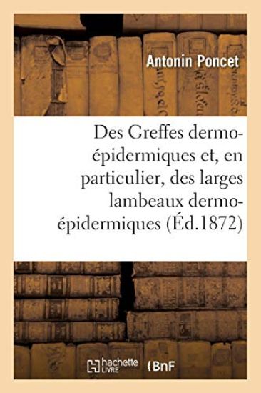 Des Greffes Dermo-Épidermiques Et, En Particulier, Des Larges Lambeaux Dermo-Épidermiques
