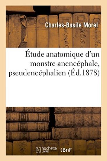 Étude Anatomique d'Un Monstre Anencéphale Pseudencéphalien de G. Saint-Hilaire