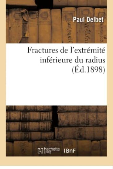 Fractures de l'Extrémité Inférieure Du Radius