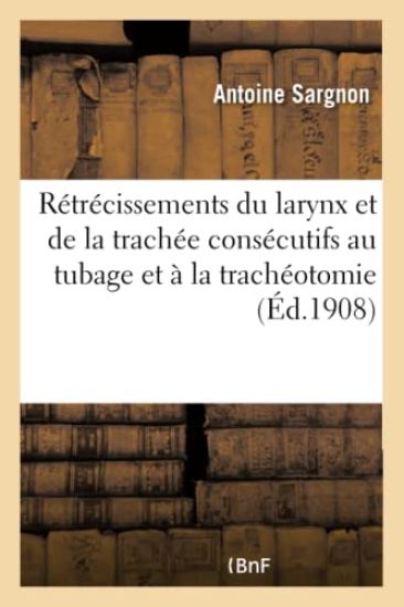 Rétrécissements Du Larynx Et de la Trachée Consécutifs Au Tubage Et À La Trachéotomie