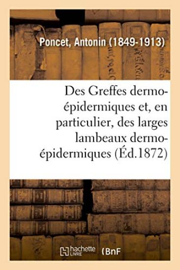 Des Greffes Dermo-Épidermiques Et, En Particulier, Des Larges Lambeaux Dermo-Épidermiques