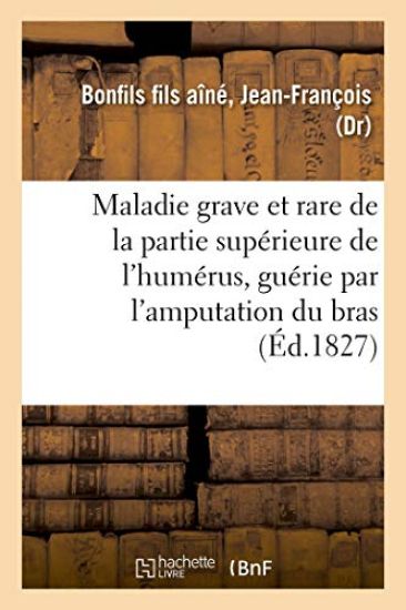 Description Succincte d'Une Maladie Grave Et Rare de la Partie Supérieure de l'Humérus