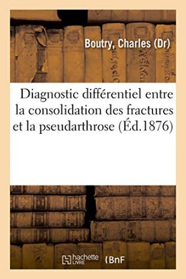 Diagnostic Différentiel Entre La Consolidation Des Fractures Et La Pseudarthrose