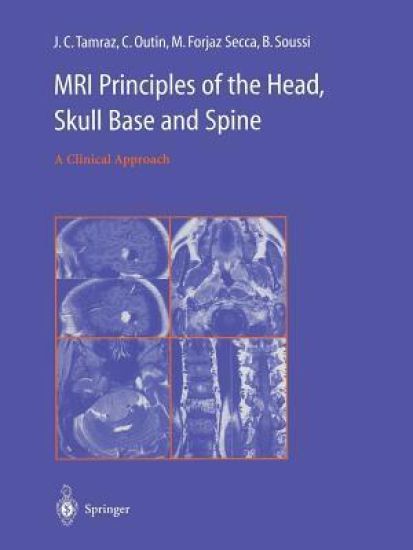 MRI Principles of the Head, Skull Base and Spine