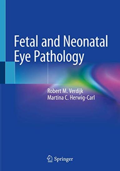 Fetal and Neonatal Eye Pathology