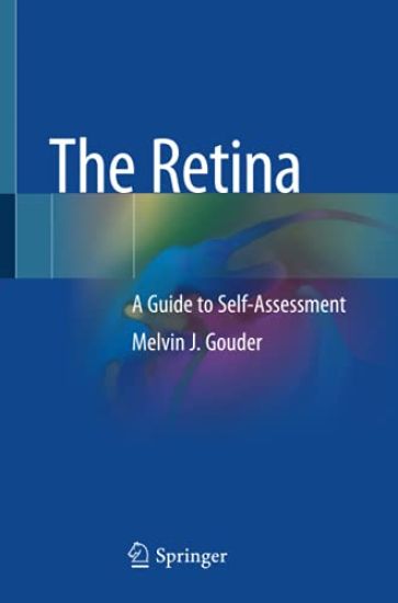 The Retina