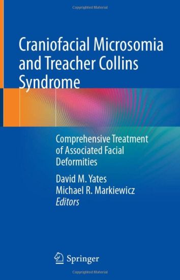 Craniofacial Microsomia and Treacher Collins Syndrome