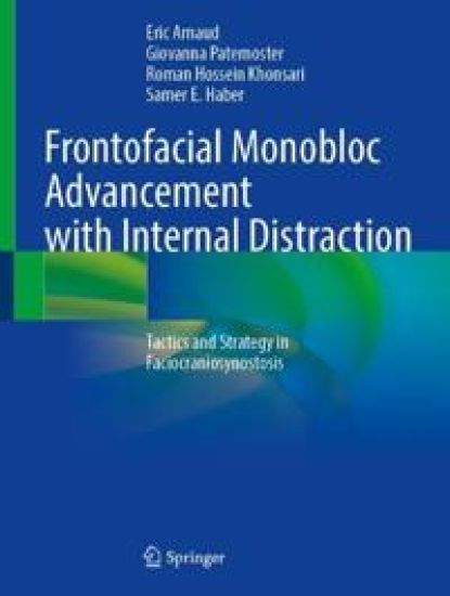 Frontofacial Monobloc Advancement with Internal Distraction