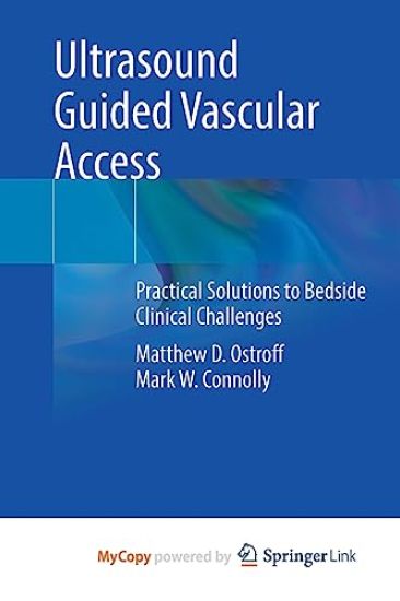 Ultrasound Guided Vascular Access