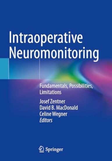 Kansikuva: Intraoperative Neuromonitoring