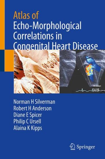 Atlas of Echo-Morphological Correlations in Congenital Heart Disease