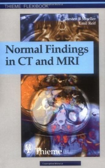 Normal Findings in CT and MRI, A1, print