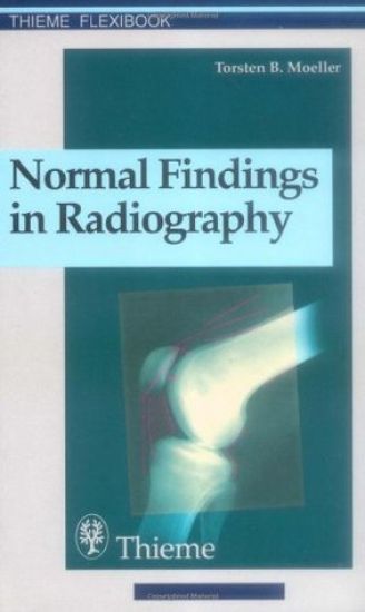 Normal Findings in Radiography