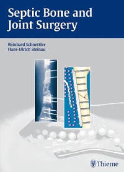 Septic Bone and Joint Surgery