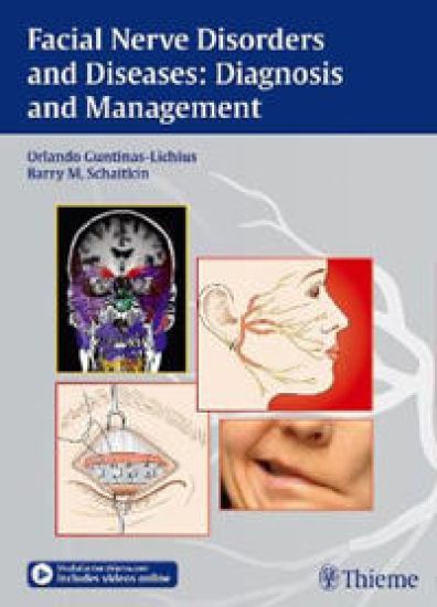 Facial Nerve Disorders and Diseases: Diagnosis and Management