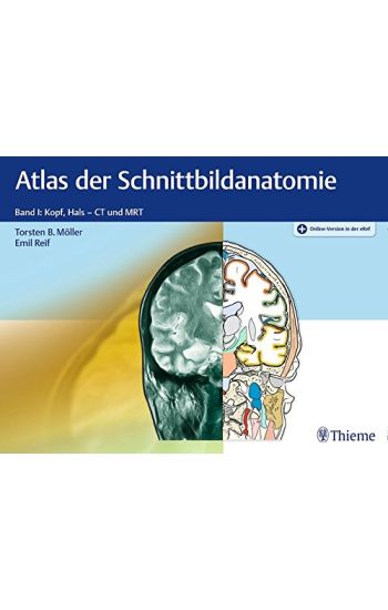 Atlas der Schnittbildanatomie. Band 01