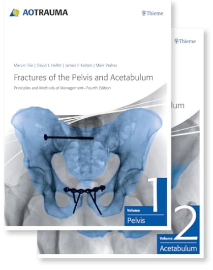Fractures of the Pelvis and Acetabulum (AO)