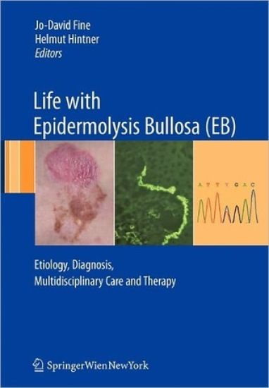 Life with Epidermolysis Bullosa (EB)