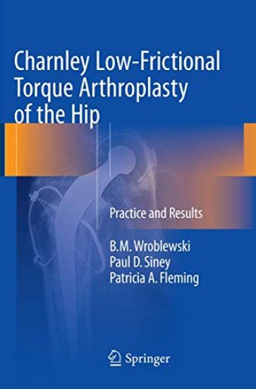 Charnley Low-Frictional Torque Arthroplasty of the Hip