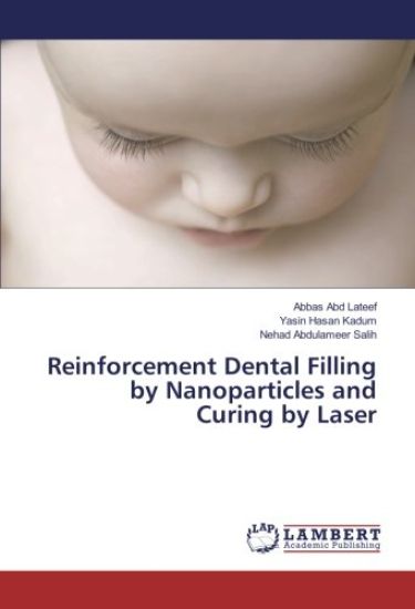 Reinforcement Dental Filling by Nanoparticles and Curing by Laser