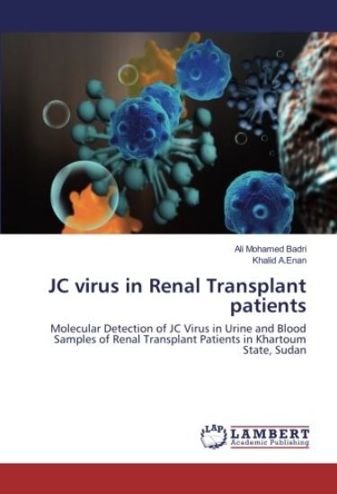 JC virus in Renal Transplant patients