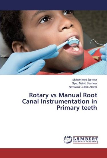 Rotary vs Manual Root Canal Instrumentation in Primary teeth