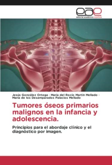 Tumores óseos primarios malignos en la infancia y adolescencia.