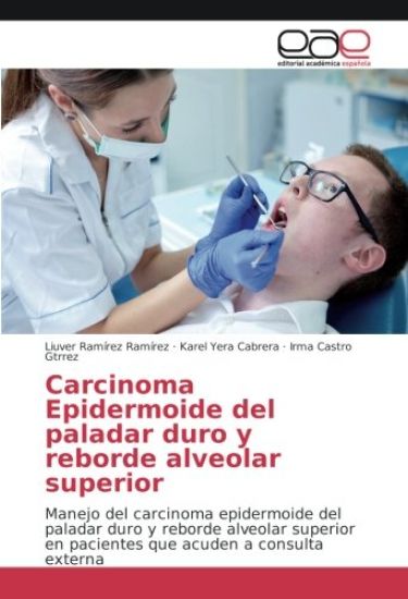 Carcinoma Epidermoide del paladar duro y reborde alveolar superior