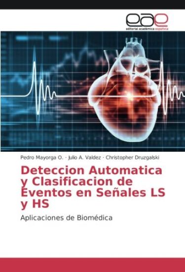 Deteccion Automatica y Clasificacion de Eventos en Señales LS y HS