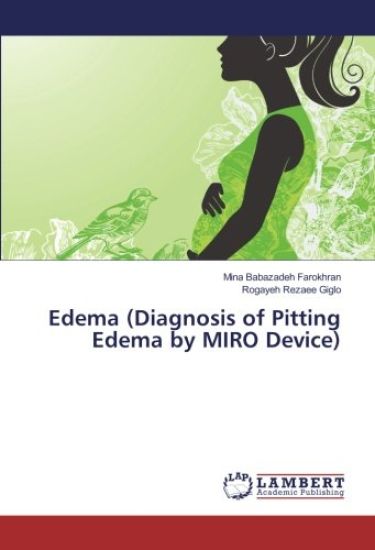 Edema (Diagnosis of Pitting Edema by MIRO Device)