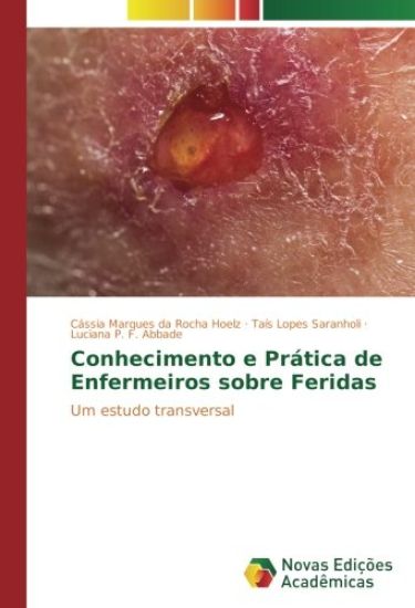 Conhecimento e Prática de Enfermeiros sobre Feridas