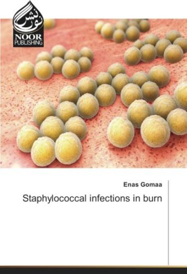 Staphylococcal infections in burn