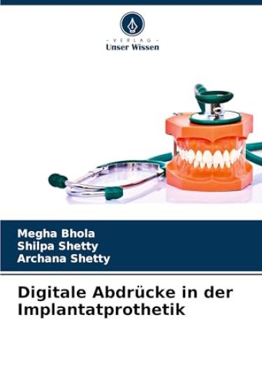 Digitale Abdrücke in der Implantatprothetik