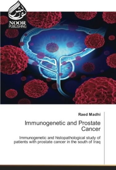 Immunogenetic and Prostate Cancer
