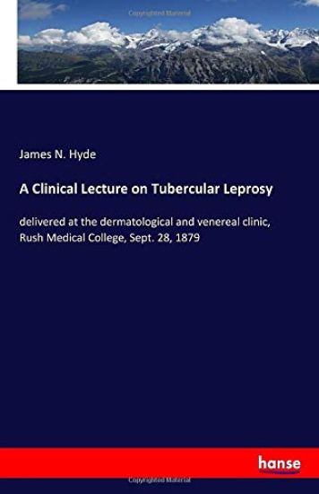 A Clinical Lecture on Tubercular Leprosy