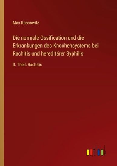 Die normale Ossification und die Erkrankungen des Knochensystems bei Rachitis und hereditärer Syphilis: II. Theil: Rachitis