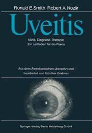 Uveitis