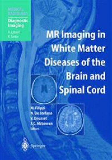 MR Imaging in White Matter Diseases of the Brain and Spinal Cord