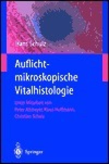 Auflichtmikroskopische Vitalhistologie