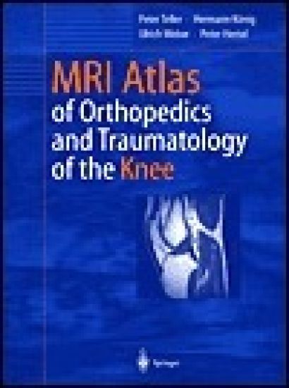 MRI Atlas of Orthopedics and Traumatology of the Knee