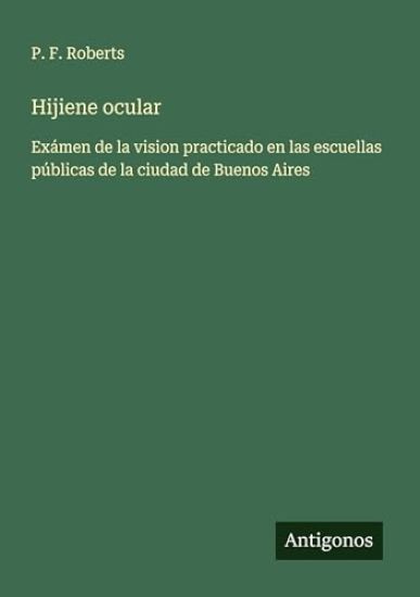 Hijiene ocular