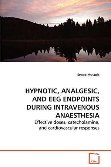 Hypnotic, Analgesic, and EEG Endpoints during Intravenous Anaesthesia