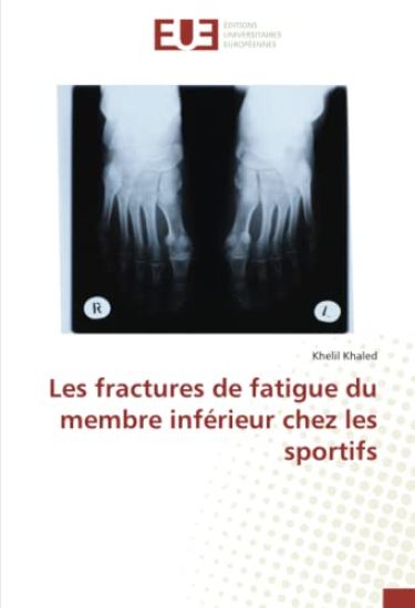 Les fractures de fatigue du membre inférieur chez les sportifs